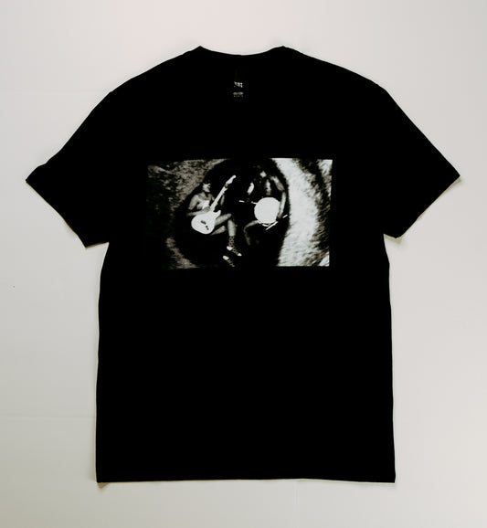 Tee Shirt: Ultrasound